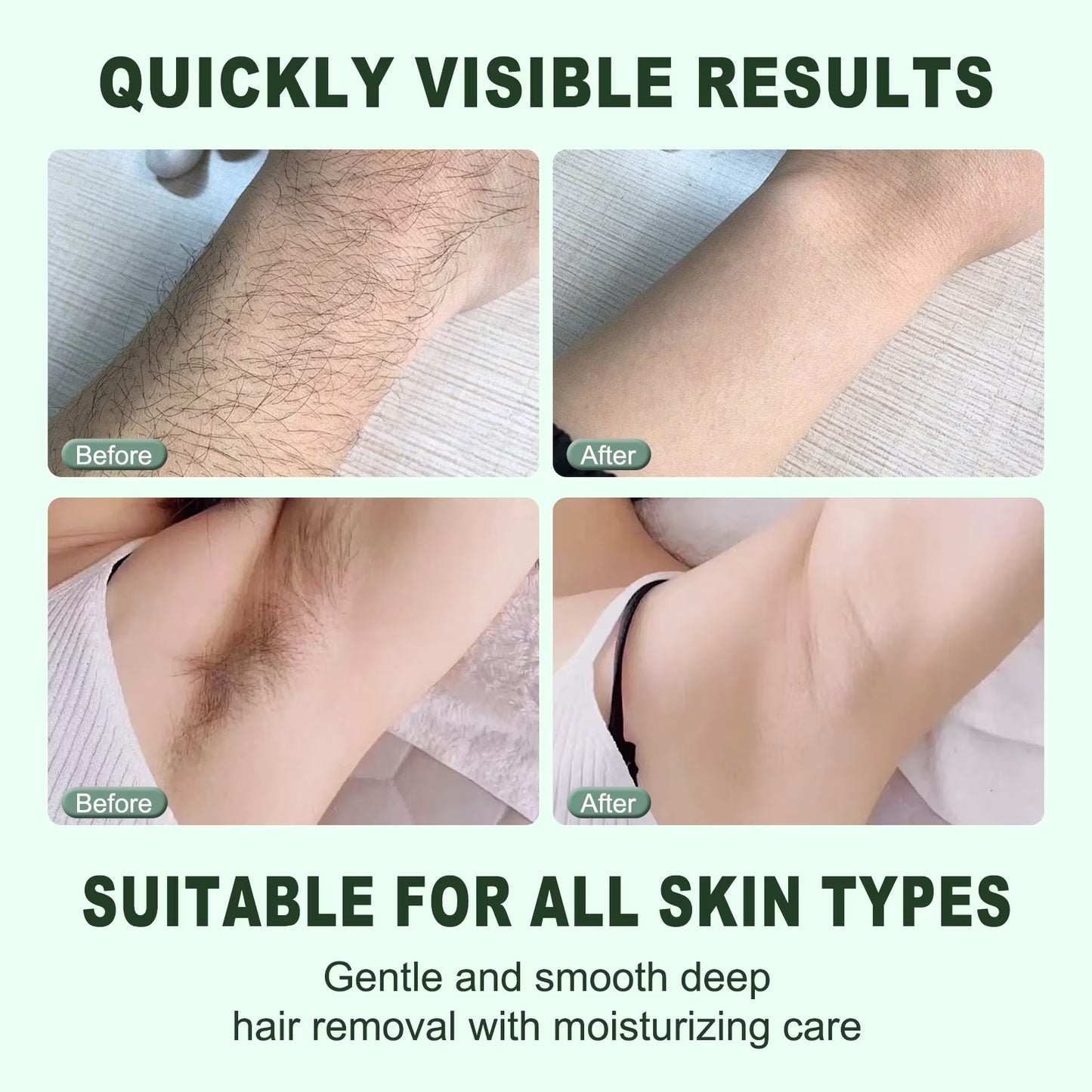 Age Vance Hair Removal Cream