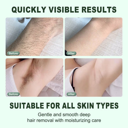 Age Vance Hair Removal Cream